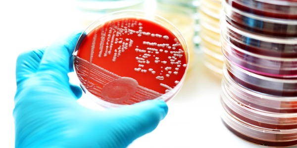 Bacteria culture in a petri dish.